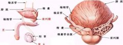前列腺结石症